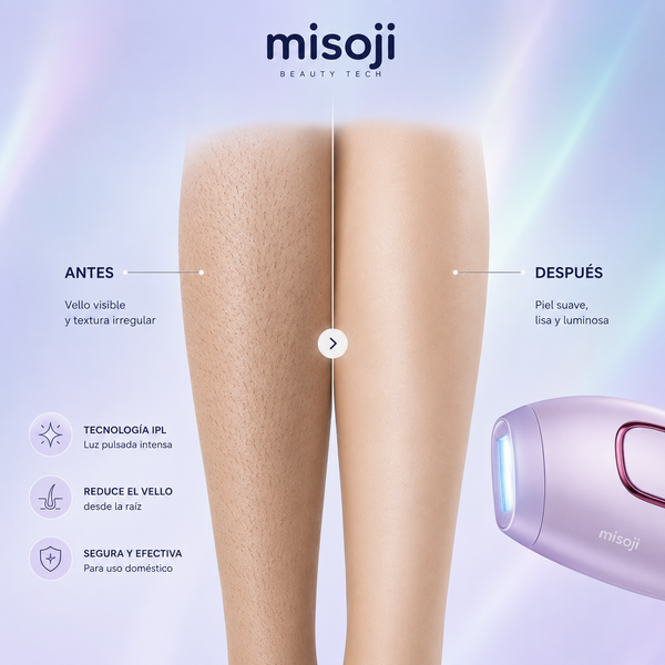 antes-y-despues-depilacion-ipl-misoji